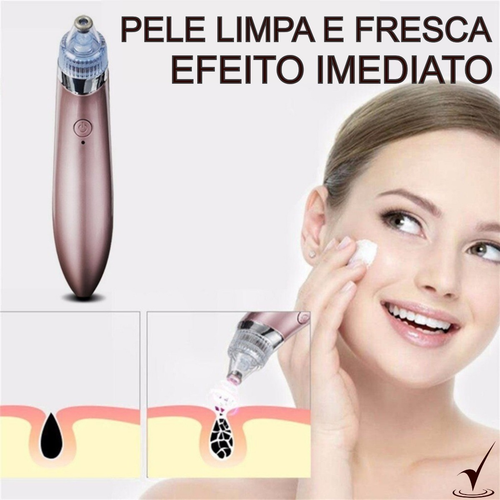 Aparelho Moderno Remove Cravos/espinhas Elétrico - Imagem 4